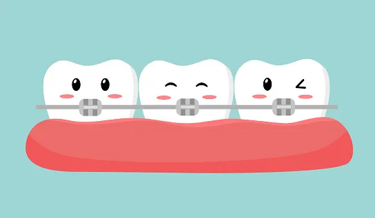 ارتودنسی دندان چگونه انجام می شود