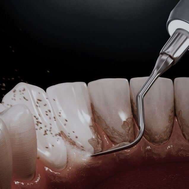 سلامت دندان + معرفی بهترین کلینیک دندان پزشکی تهران