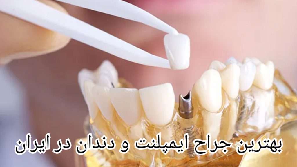 بهترین جراح ایمپلنت و دندان در ایران