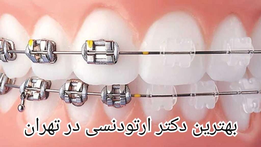 مراحل درمان شما توسط بهترین دکتر ارتودنسی در تهران