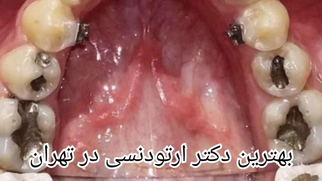 معیارهای انتخاب بهترین دکتر ارتودنسی در تهران