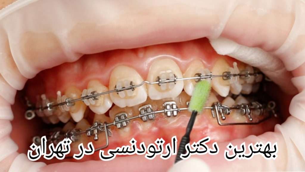 سایر پزشکان لیست بهترین دکتر ارتودنسی در تهران
