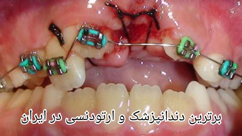 لیست برترین دندانپزشک و ارتودنسی در ایران