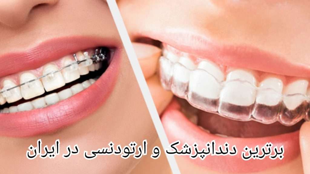 برترین دندانپزشک و ارتودنسی در ایران