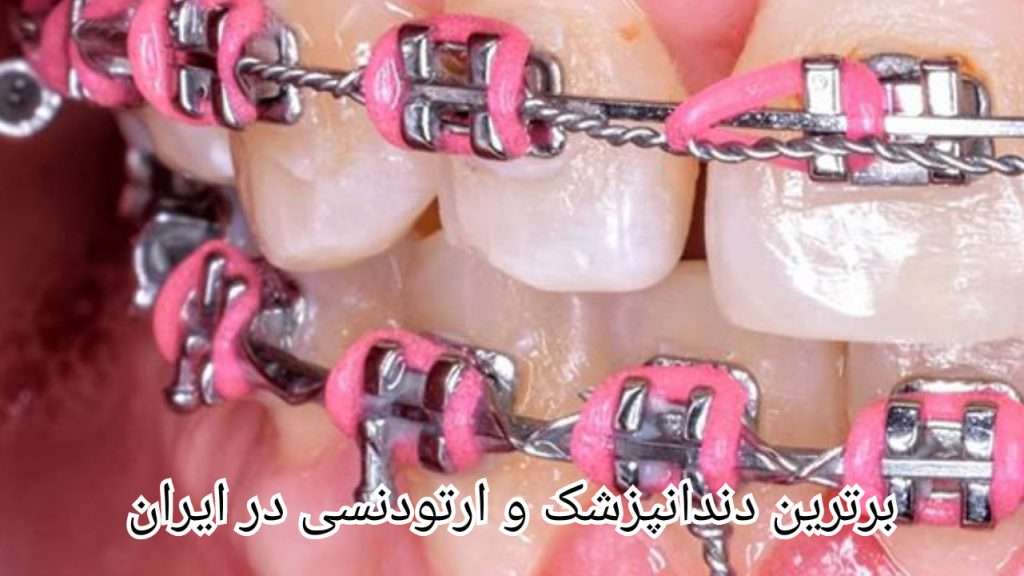 بهبود بهداشت دهان و دندان