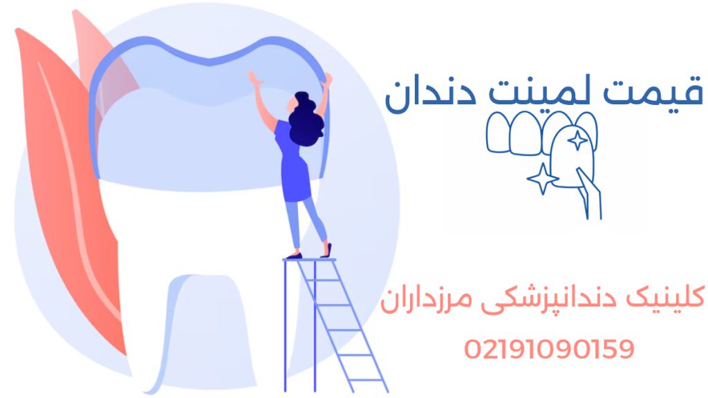 قیمت لمینت دندان - تصویری انیمیشنی از لمینت دندان
