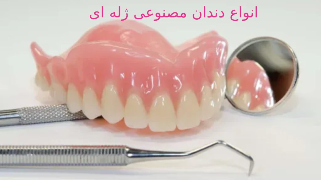 انواع دندان مصنوعی ژله ای