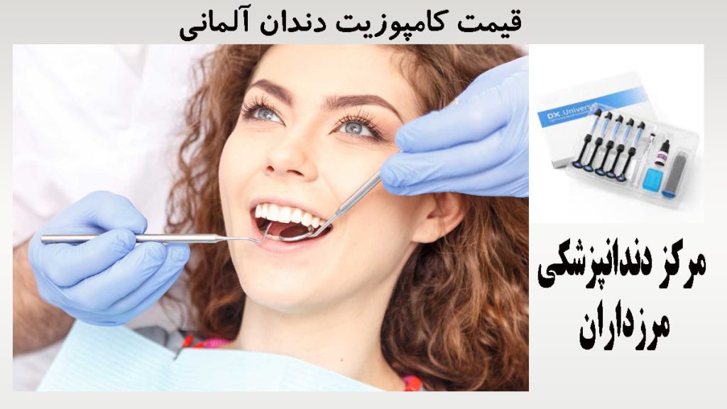 کامپوزیت دندان آلمانی یک خانم بعد از کامپوزیت دندان و دستهای یک دندانپزشک در حال انجام کار