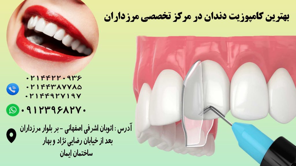 دو تصویر از کامپوزیت دندان در پس زمینه سبز