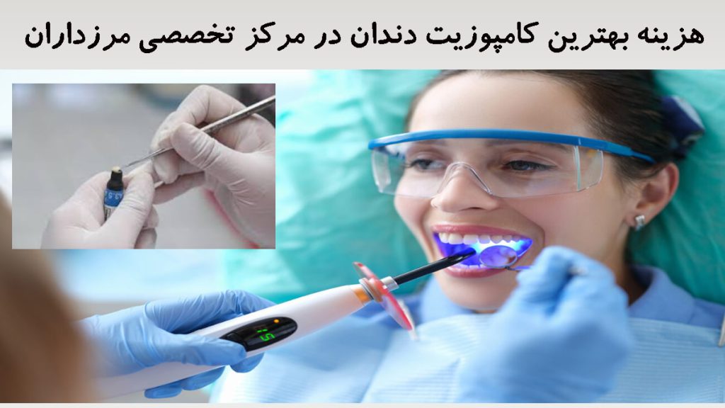 بهترین کامپوزیت دندان یک خانم در حال انجام کامپوزیت دندان