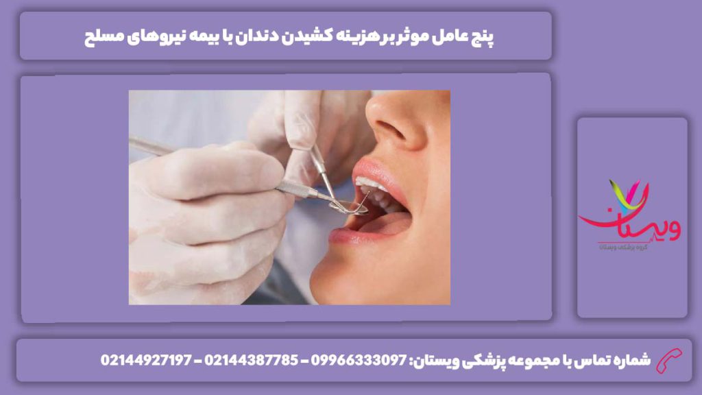 عوامل تاثیرگذار بر هزینه دندان کشیدن هزینه کشیدن دندان با بیمه نیروهای مسلح