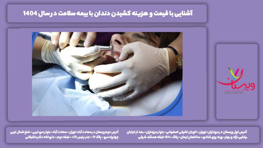 هزینه کشیدن دندان با بیمه سلامت