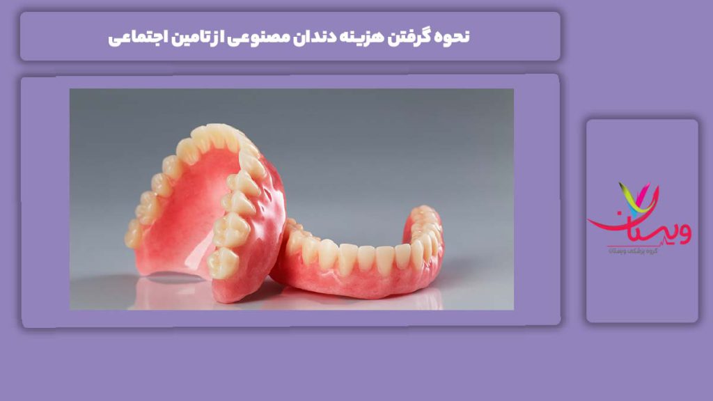 مرحلههای گرفتن تعرفه دندان مصنوعی از بیمه تامین اجتماعی نحوه گرفتن هزینه دندان مصنوعی از تامین اجتماعی
