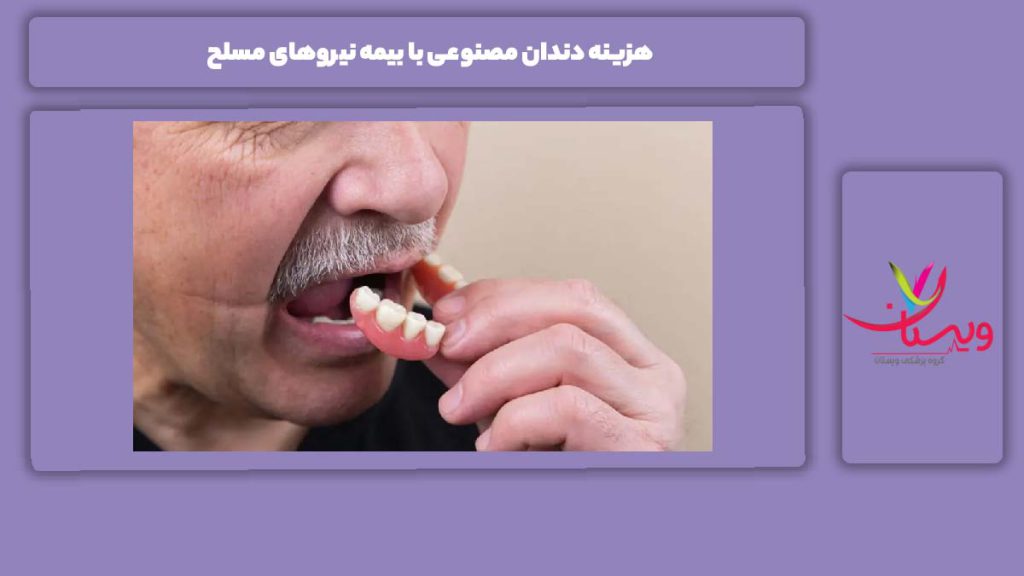 قیمت دندان مصنوعی با بیمه نیروهای مسلح هزینه دندان مصنوعی با بیمه نیروهای مسلح