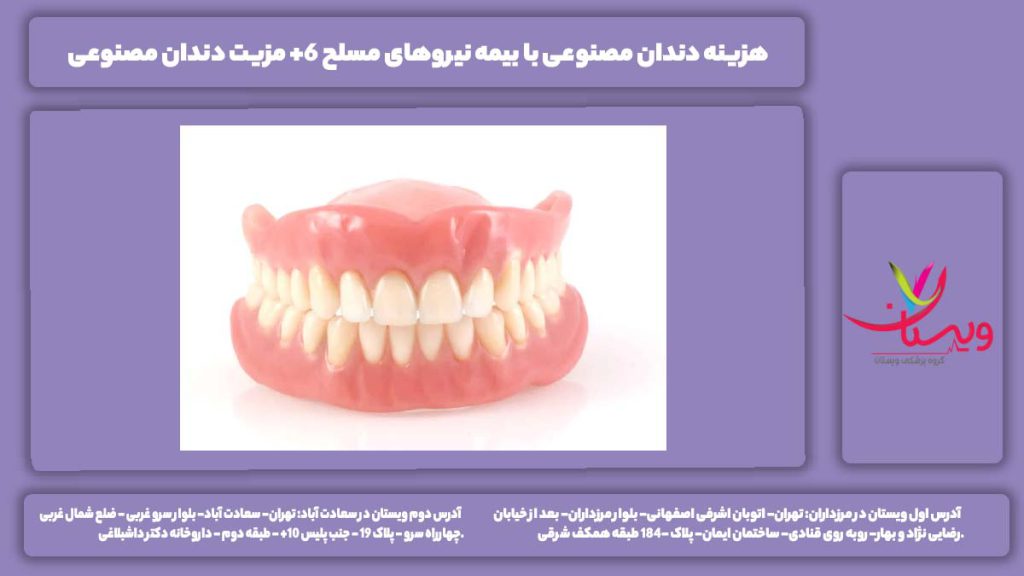 هزینه دندان مصنوعی با بیمه نیروهای مسلح