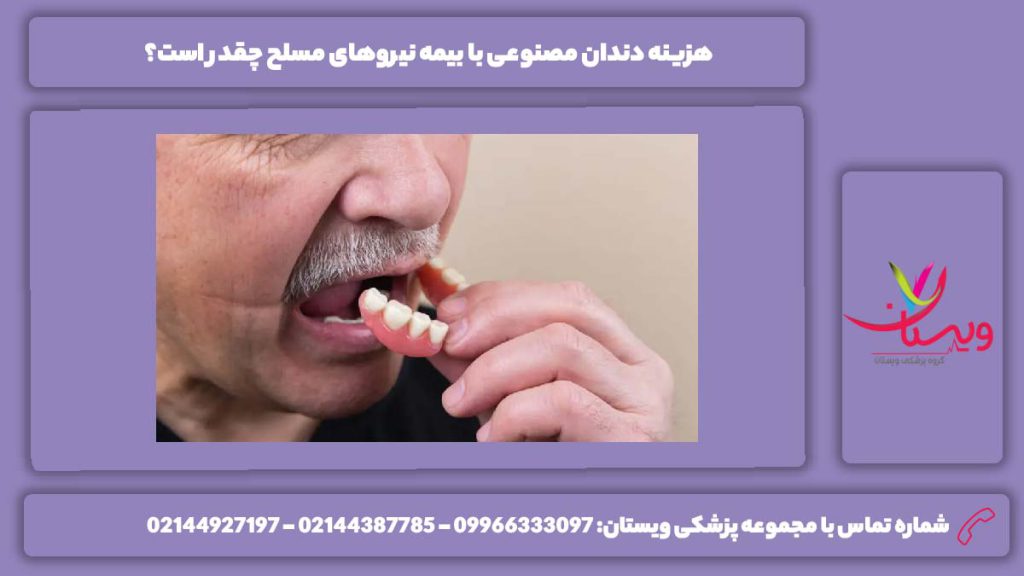 قیمت دندان مصنوعی با بیمه نیروی مسلح هزینه دندان مصنوعی با بیمه نیروهای مسلح