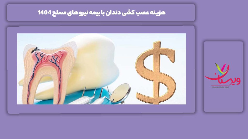 تعرفه عصب کشی با بیمه نیروی مسلح هزینه تقریبی عصب کشی