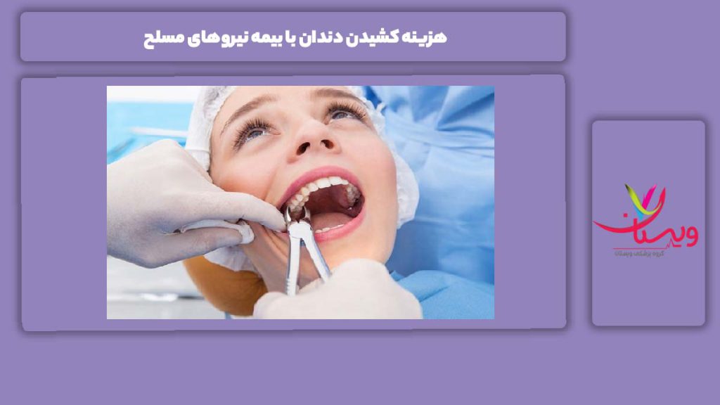 قیمت دندان کشیدن با بیمه نیروهای مسلح هزینه کشیدن دندان با بیمه نیروهای مسلح