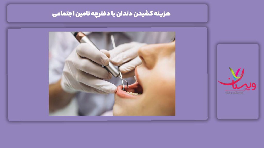 ویژگی کشیدن دندان با دفترچه تامین اجتماعی هزینه کشیدن دندان با دفترچه تامین اجتماعی