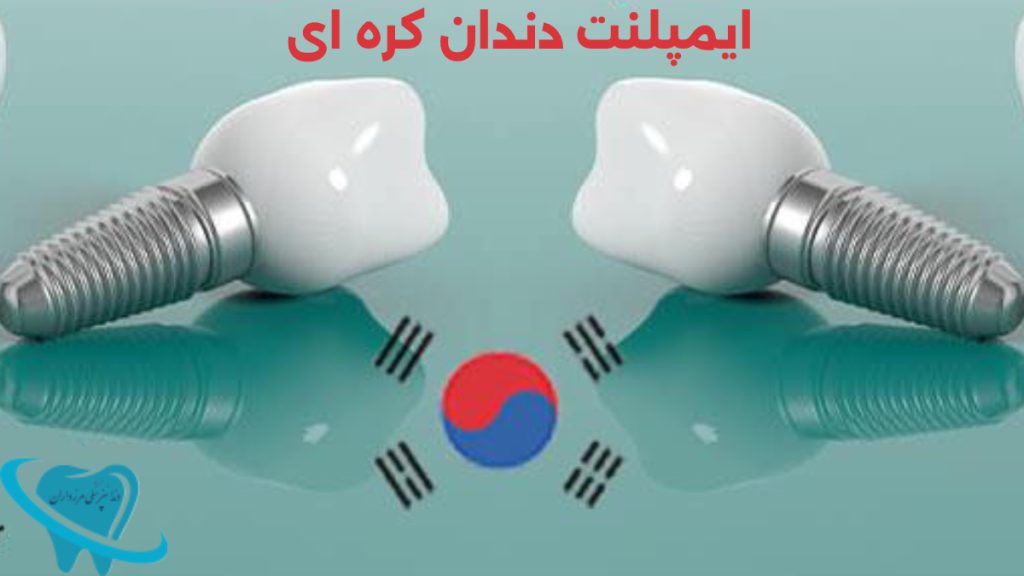 ایمپلنت دندان کره ای تصویری از ایمپلنت دندان به همراه پرچم کشور کره