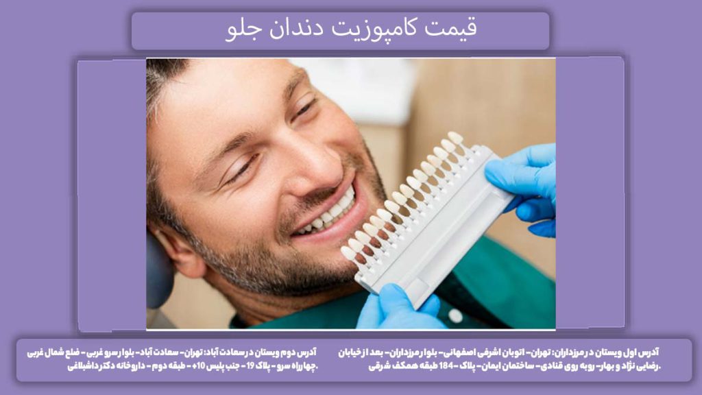 هزینه ترمیم کامپوزیت قیمت کامپوزیت دندان جلو