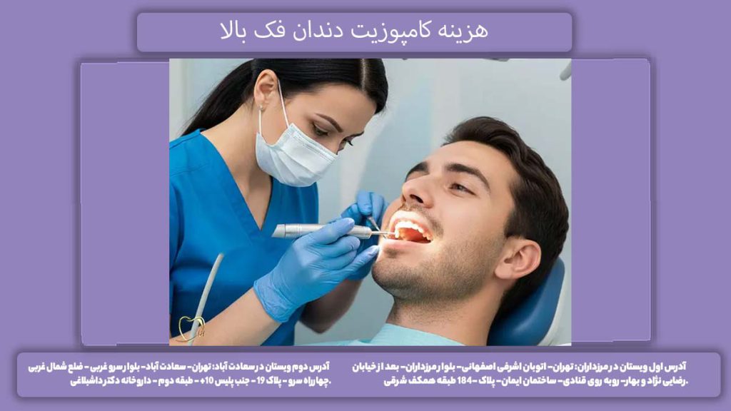 کامپوزیت دندان بالایی هزینه کامپوزیت دندان فک بالا