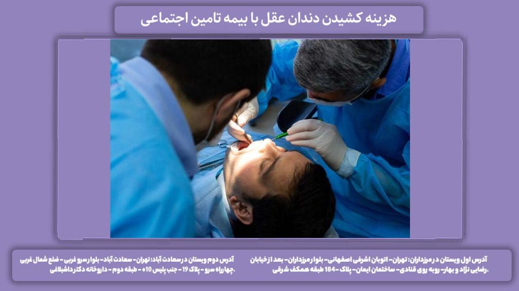 قیمت کشیدن دندان هزینه کشیدن دندان عقل با بیمه تامین اجتماعی