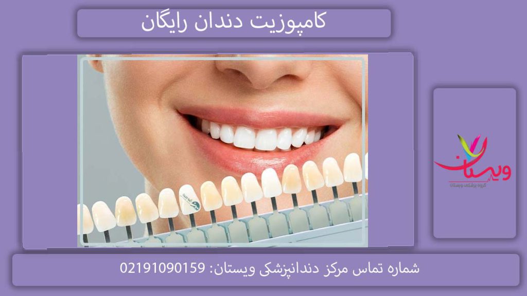 کامپوزیت دندان رایگان هزینه کامپوزیت دندان