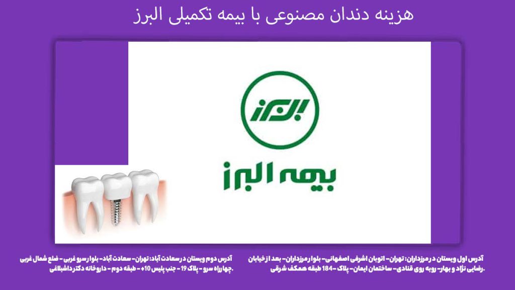 پوشش بیمه البرز برای پروتز دندان هزینه دندان مصنوعی با بیمه تکمیلی البرز