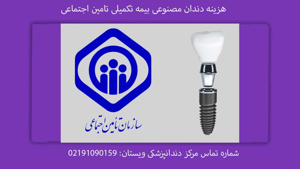 قیمت دندان مصنوعی بیمه تامین اجتماعی پروتز دندان با بیمه تکمیلی اجتماعی