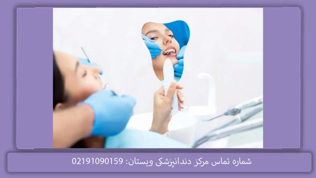 کامپوزیت دندان رایگان هزینه کامپوزیت دندان با بیمه تکمیلی و رایگان