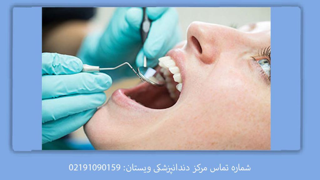 تعرفه دندانپزشکی بیمه تکمیلی نوین هزینه در دندانپزشکی طرف قرارداد با بیمه نوین در تهران