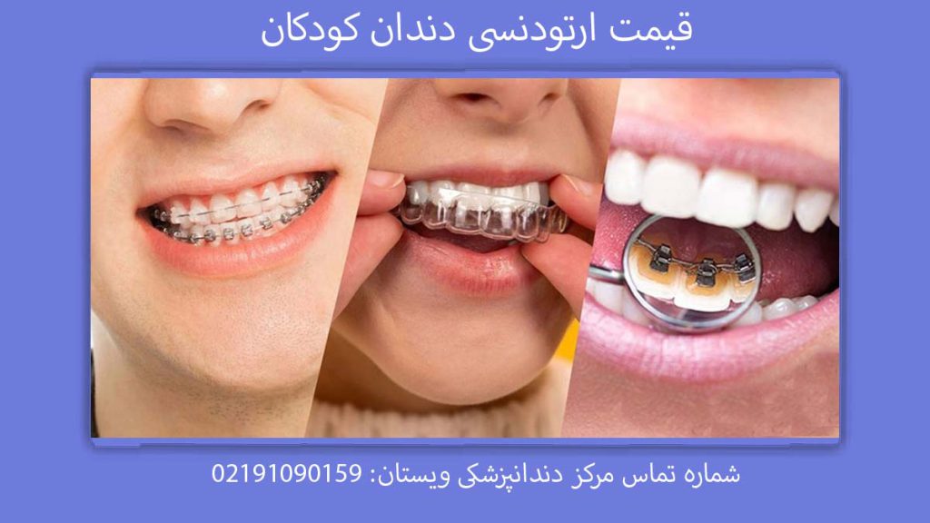 هزینه ارتودنسی اطفال قیمت ارتودنسی دندان برای کودکان